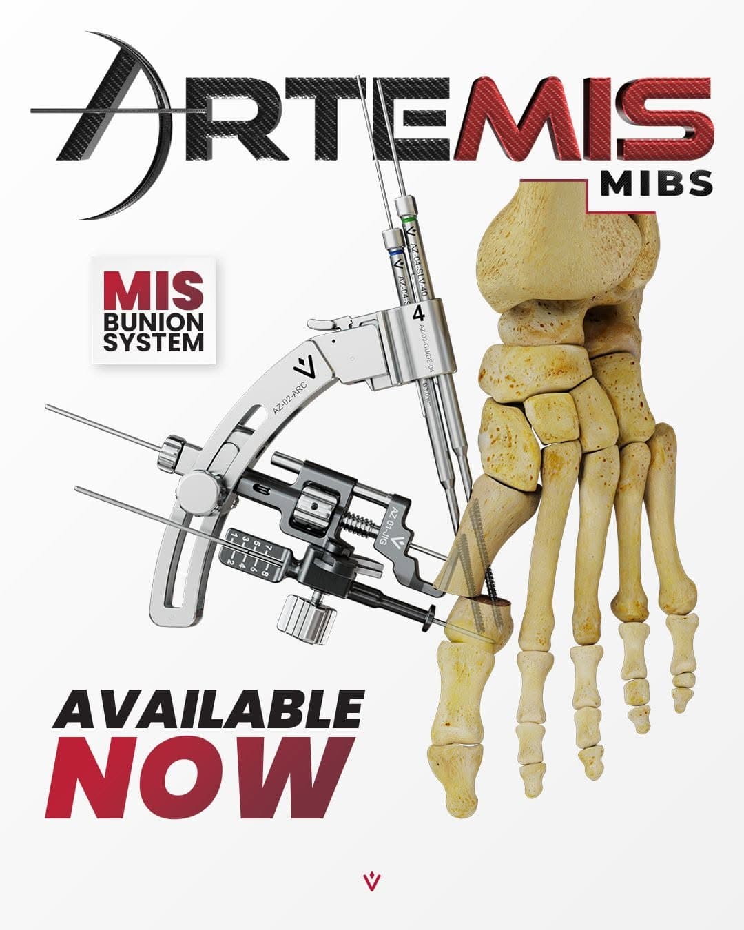Artemis MIBS launch graphic showing the MIS bunion system on a foot model, with the line Available Now.